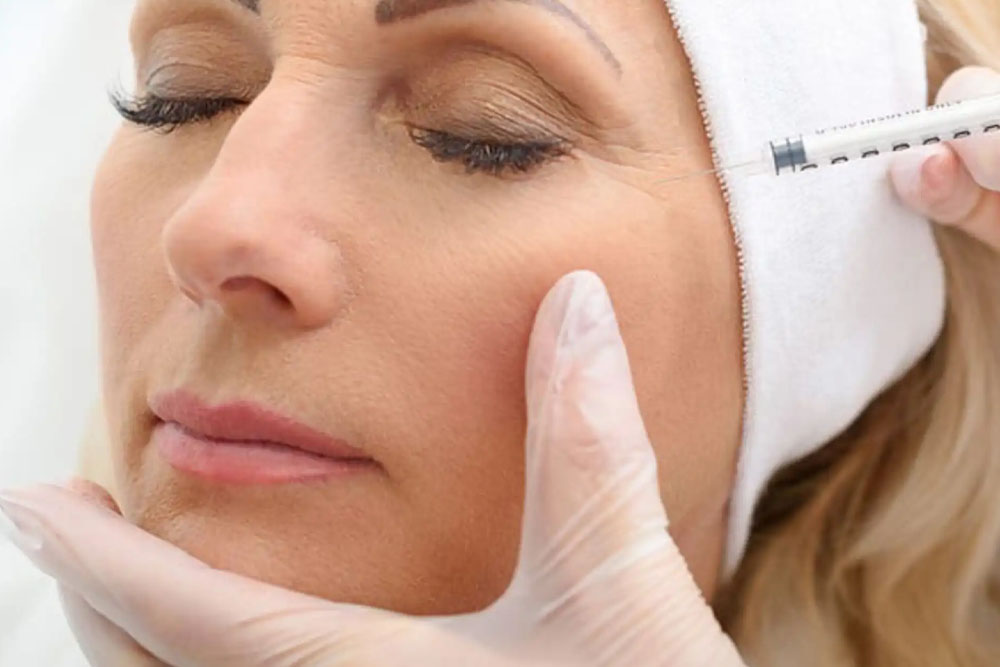 Lip fillers in Dubai